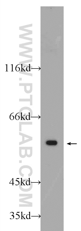 WB analysis of Jurkat using 24896-1-AP