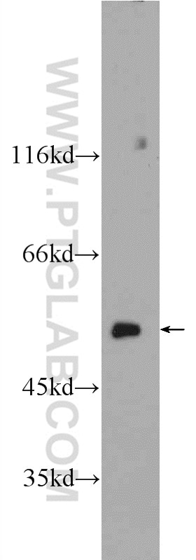 Western Blot (WB) analysis of mouse testis tissue using CCT2 Polyclonal antibody (24896-1-AP)
