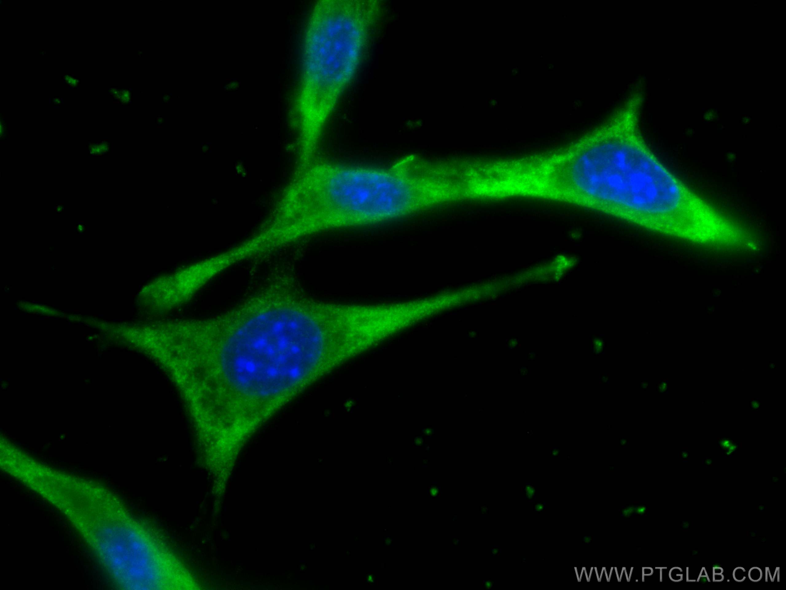 Immunofluorescence (IF) / fluorescent staining of NIH/3T3 cells using CCT2 Monoclonal antibody (68214-1-Ig)