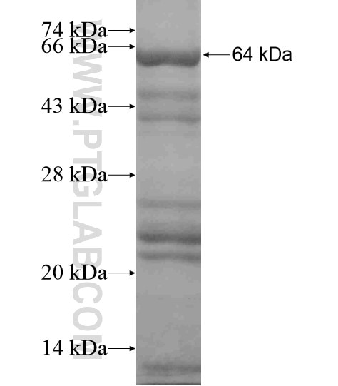 CCT2 fusion protein Ag19219 SDS-PAGE CCT2 fusion protein Ag19219 SDS-PAGE