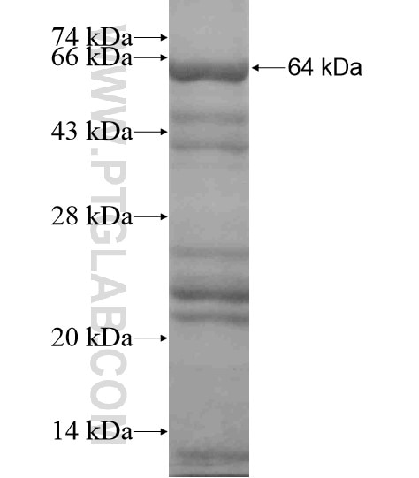 CCT2 fusion protein Ag19219 SDS-PAGE