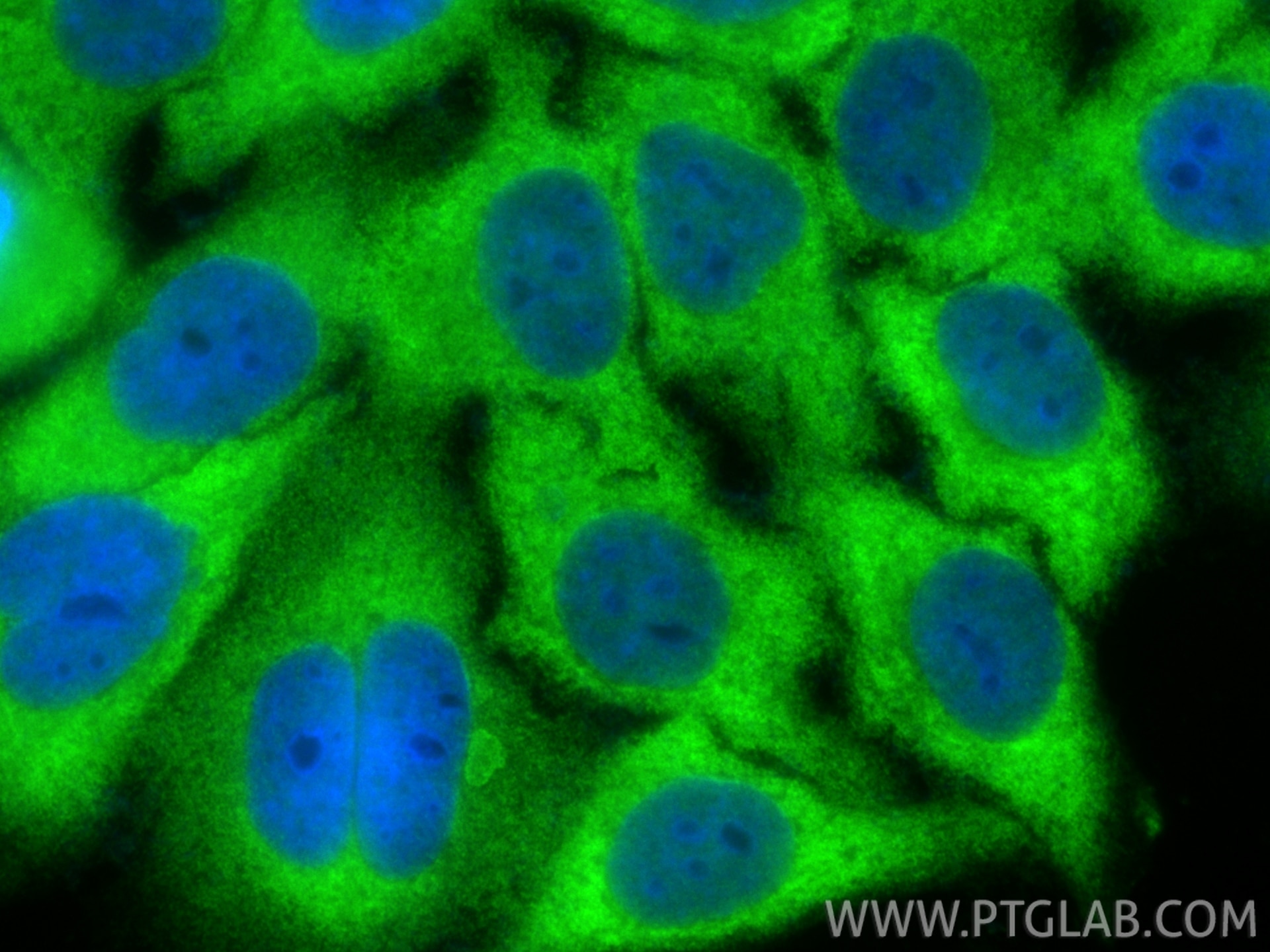 Immunofluorescence (IF) / fluorescent staining of HepG2 cells using CCT3 Polyclonal antibody (10571-1-AP)