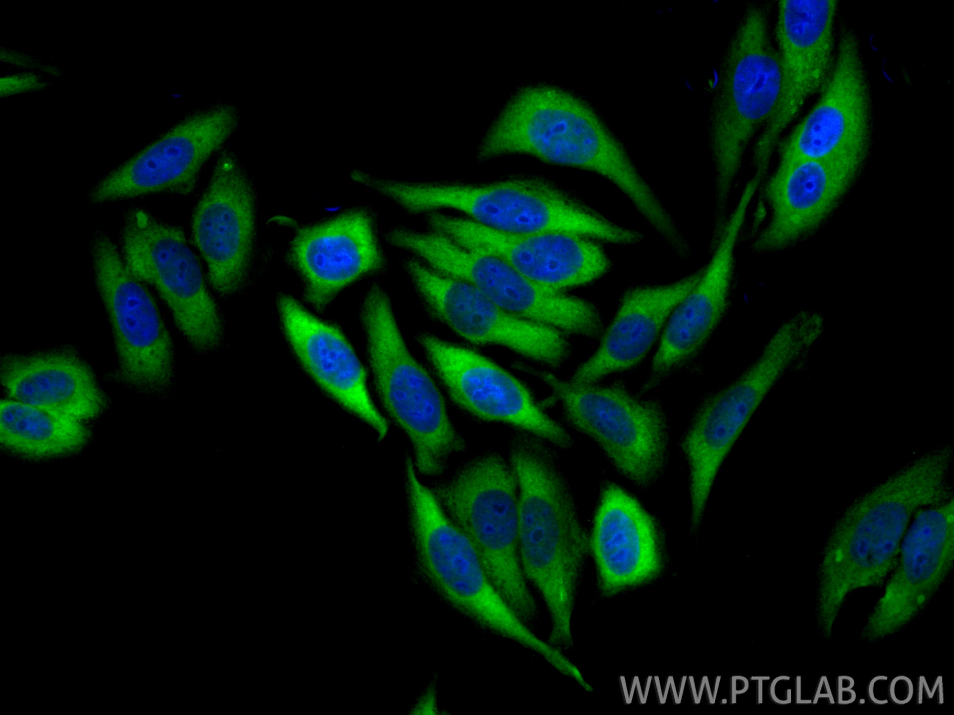 Immunofluorescence (IF) / fluorescent staining of HepG2 cells using CCT3 Polyclonal antibody (10571-1-AP)