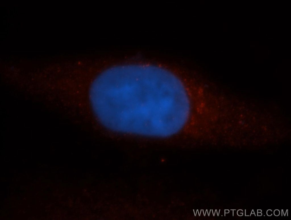 Immunofluorescence (IF) / fluorescent staining of HepG2 cells using CCT3 Polyclonal antibody (10571-1-AP)