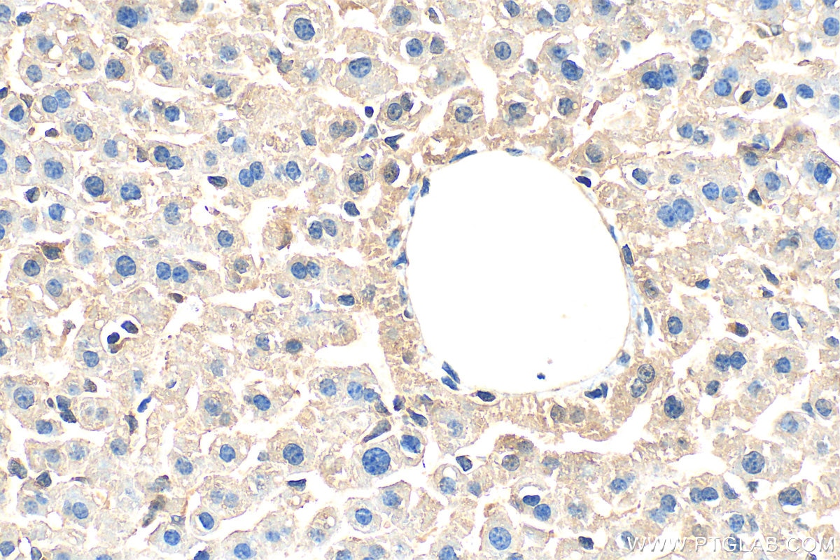 Immunohistochemistry (IHC) staining of mouse liver tissue using CCT3 Polyclonal antibody (10571-1-AP)