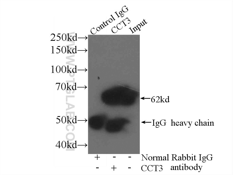 Immunoprecipitation (IP) experiment of mouse brain tissue using CCT3 Polyclonal antibody (10571-1-AP)