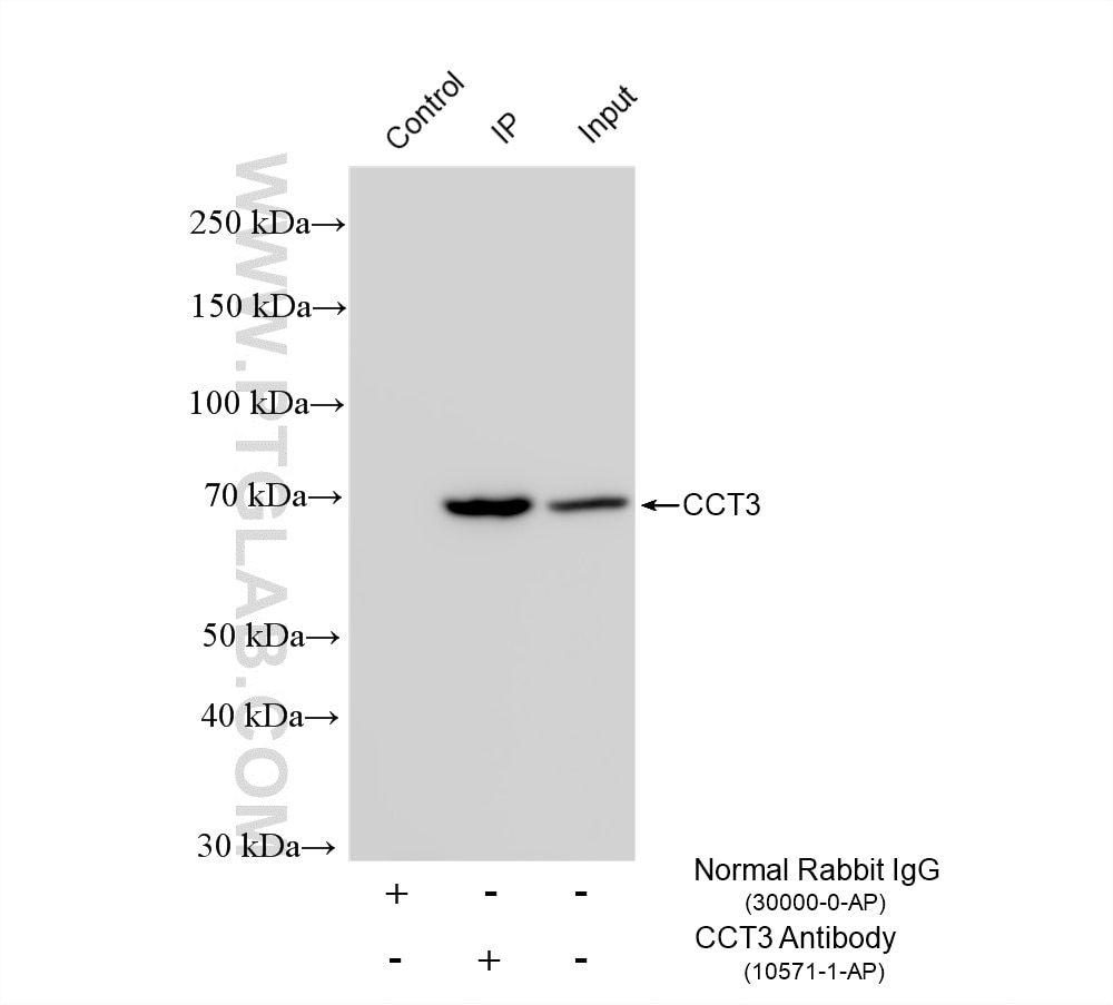 Immunoprecipitation (IP) experiment of mouse brain tissue using CCT3 Polyclonal antibody (10571-1-AP)