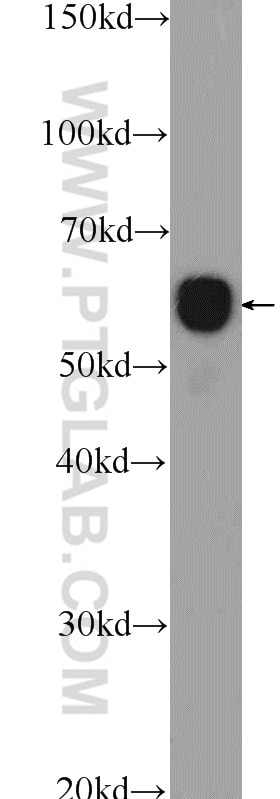 Western Blot (WB) analysis of rat kidney tissue using CCT3 Polyclonal antibody (10571-1-AP)