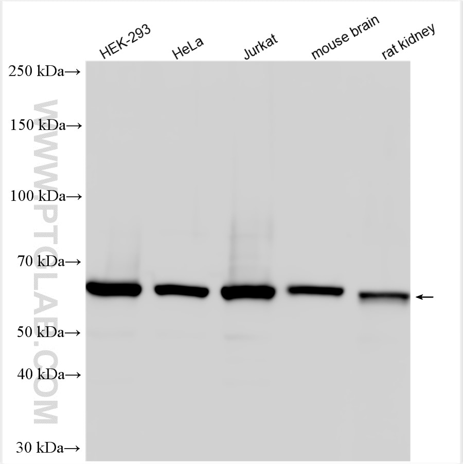 Western Blot (WB) analysis of various lysates using CCT3 Polyclonal antibody (10571-1-AP)