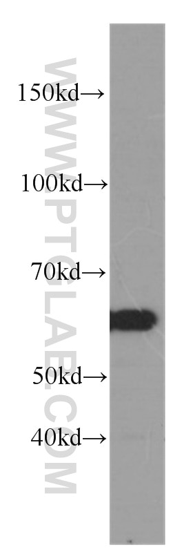 Western Blot (WB) analysis of COLO 320 cells using CCT3 Monoclonal antibody (60264-1-Ig)