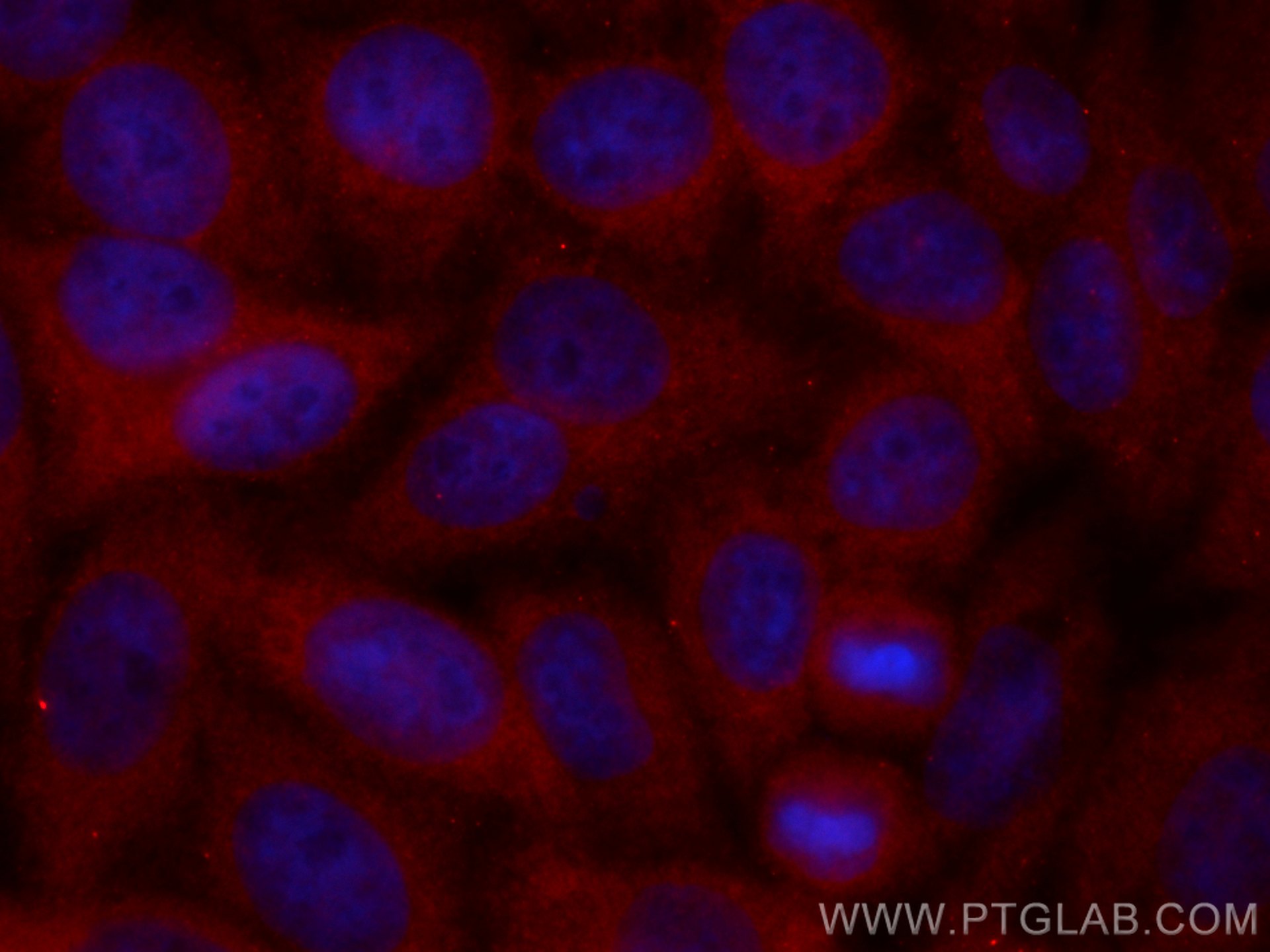 Immunofluorescence (IF) / fluorescent staining of HepG2 cells using CoraLite®594-conjugated CCT3 Monoclonal antibody (CL594-60264)