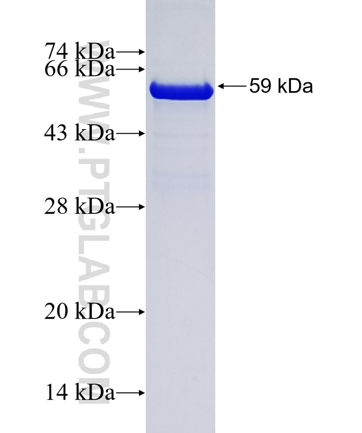 CCT3 fusion protein Ag0843 SDS-PAGE