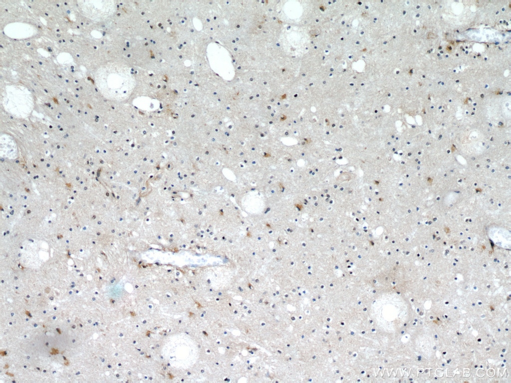 Immunohistochemistry (IHC) staining of human brain tissue using CCT4 Polyclonal antibody (21524-1-AP)