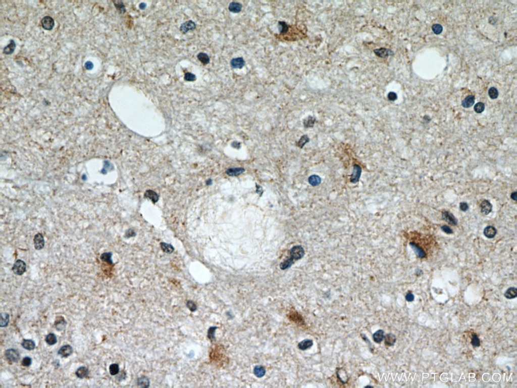 Immunohistochemistry (IHC) staining of human brain tissue using CCT4 Polyclonal antibody (21524-1-AP)