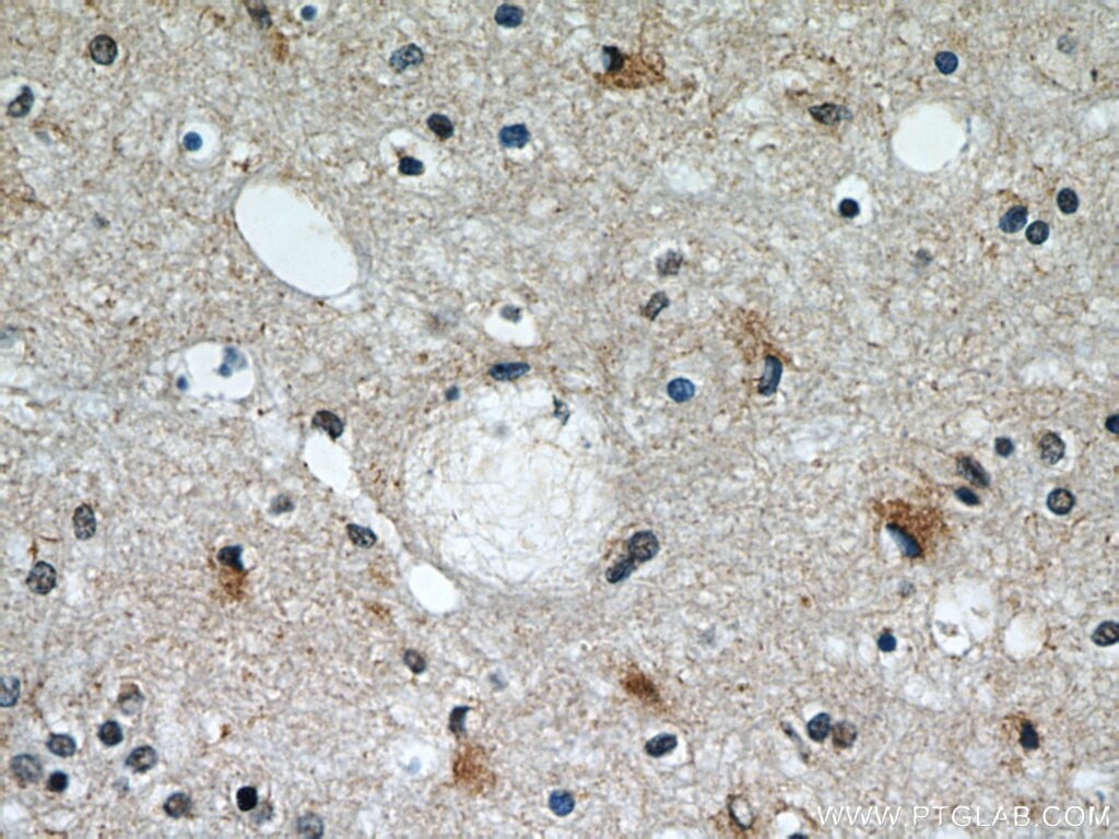 Immunohistochemistry (IHC) staining of human brain tissue using CCT4 Polyclonal antibody (21524-1-AP)