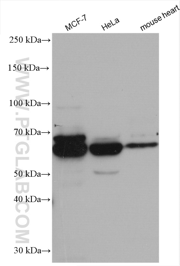 Western Blot (WB) analysis of various lysates using CCT4 Polyclonal antibody (21524-1-AP)