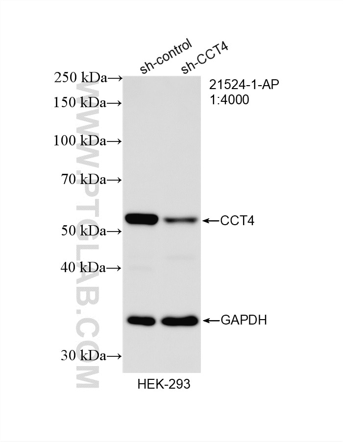 Western Blot (WB) analysis of HEK-293 cells using CCT4 Polyclonal antibody (21524-1-AP)