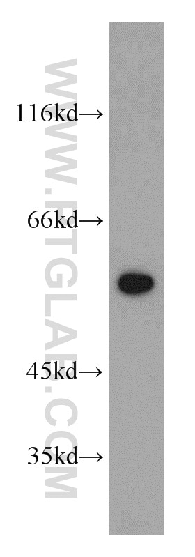 Western Blot (WB) analysis of HeLa cells using CCT4 Polyclonal antibody (21524-1-AP)
