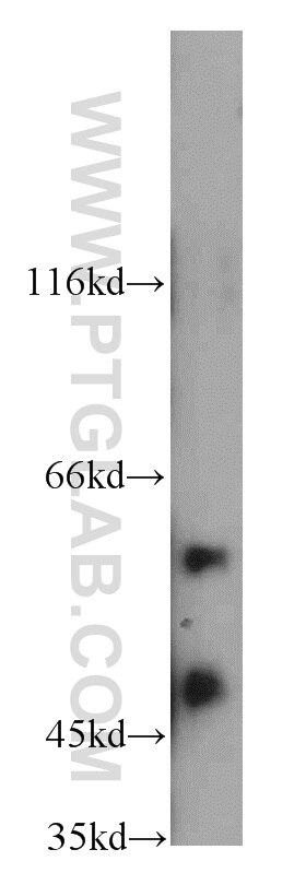 Western Blot (WB) analysis of mouse heart tissue using CCT4 Polyclonal antibody (21524-1-AP)