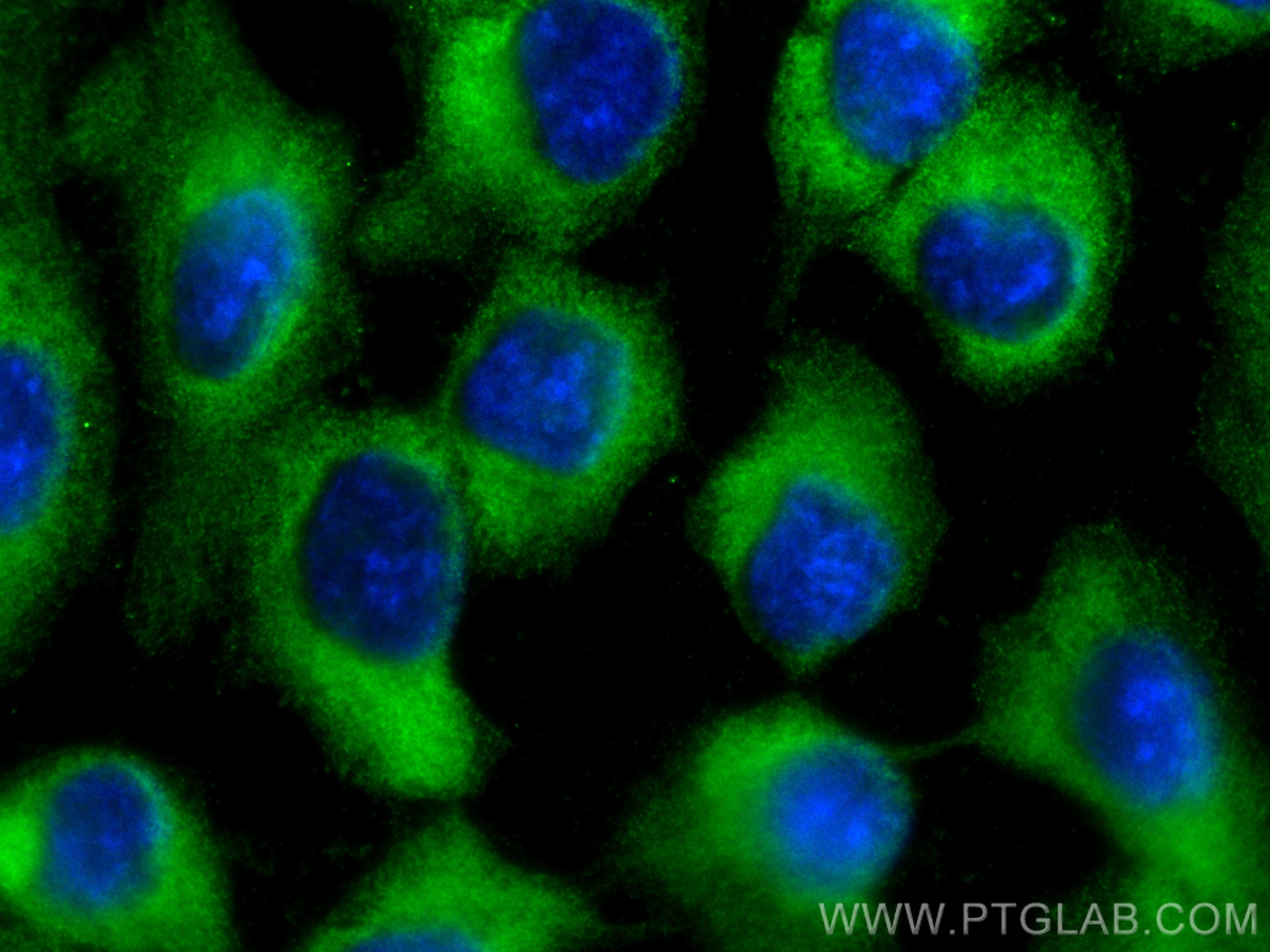 Immunofluorescence (IF) / fluorescent staining of U2OS cells using CCT4 Monoclonal antibody (67455-1-Ig)