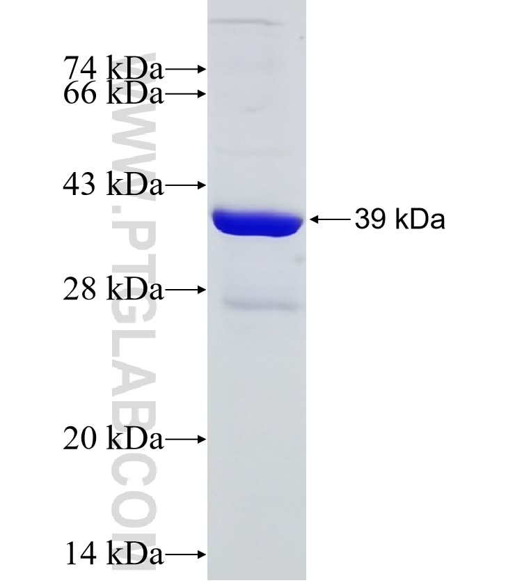 CCT4 fusion protein Ag17084 SDS-PAGE