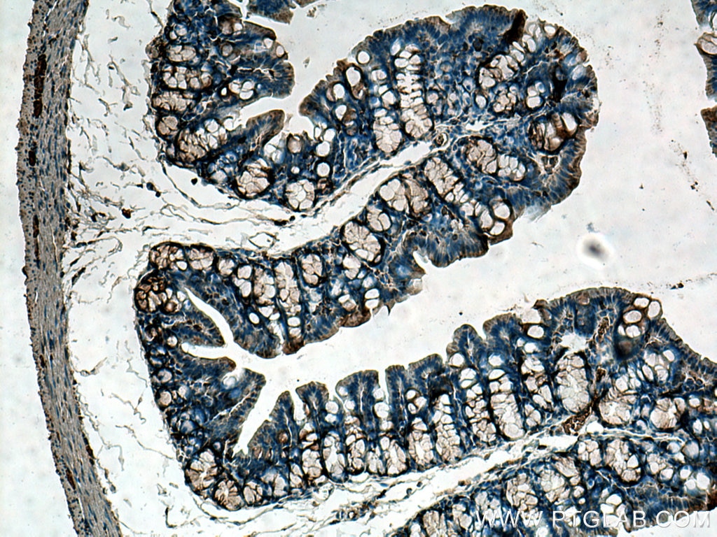 Immunohistochemistry (IHC) staining of mouse colon tissue using CCT5 Polyclonal antibody (11603-1-AP)