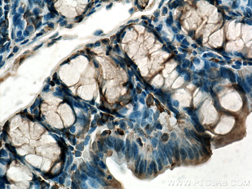 IHC staining of mouse colon using 11603-1-AP