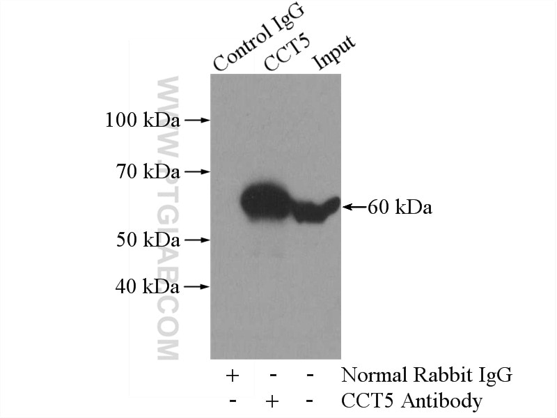 Immunoprecipitation (IP) experiment of HeLa cells using CCT5 Polyclonal antibody (11603-1-AP)