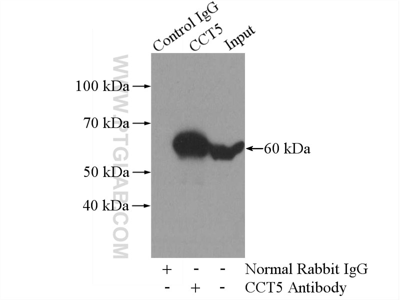 IP experiment of HeLa using 11603-1-AP