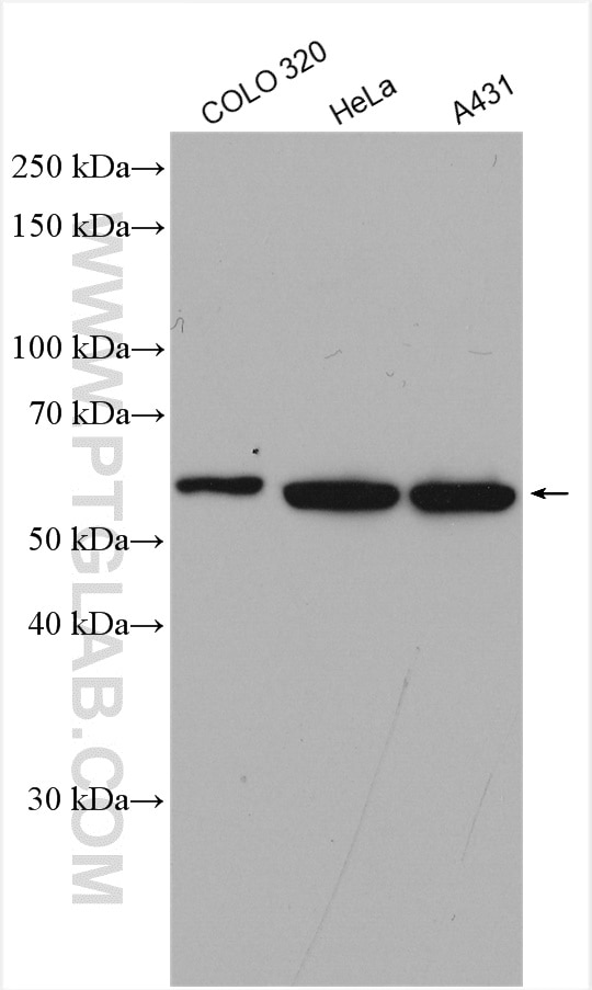 Western Blot (WB) analysis of various lysates using CCT5 Polyclonal antibody (11603-1-AP)
