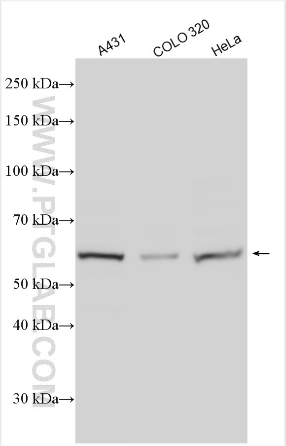 Western Blot (WB) analysis of various lysates using CCT5 Polyclonal antibody (11603-1-AP)