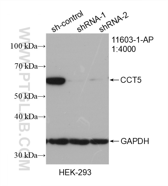 Western Blot (WB) analysis of HEK-293 cells using CCT5 Polyclonal antibody (11603-1-AP)