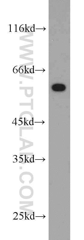 Western Blot (WB) analysis of HeLa cells using CCT5 Polyclonal antibody (11603-1-AP)