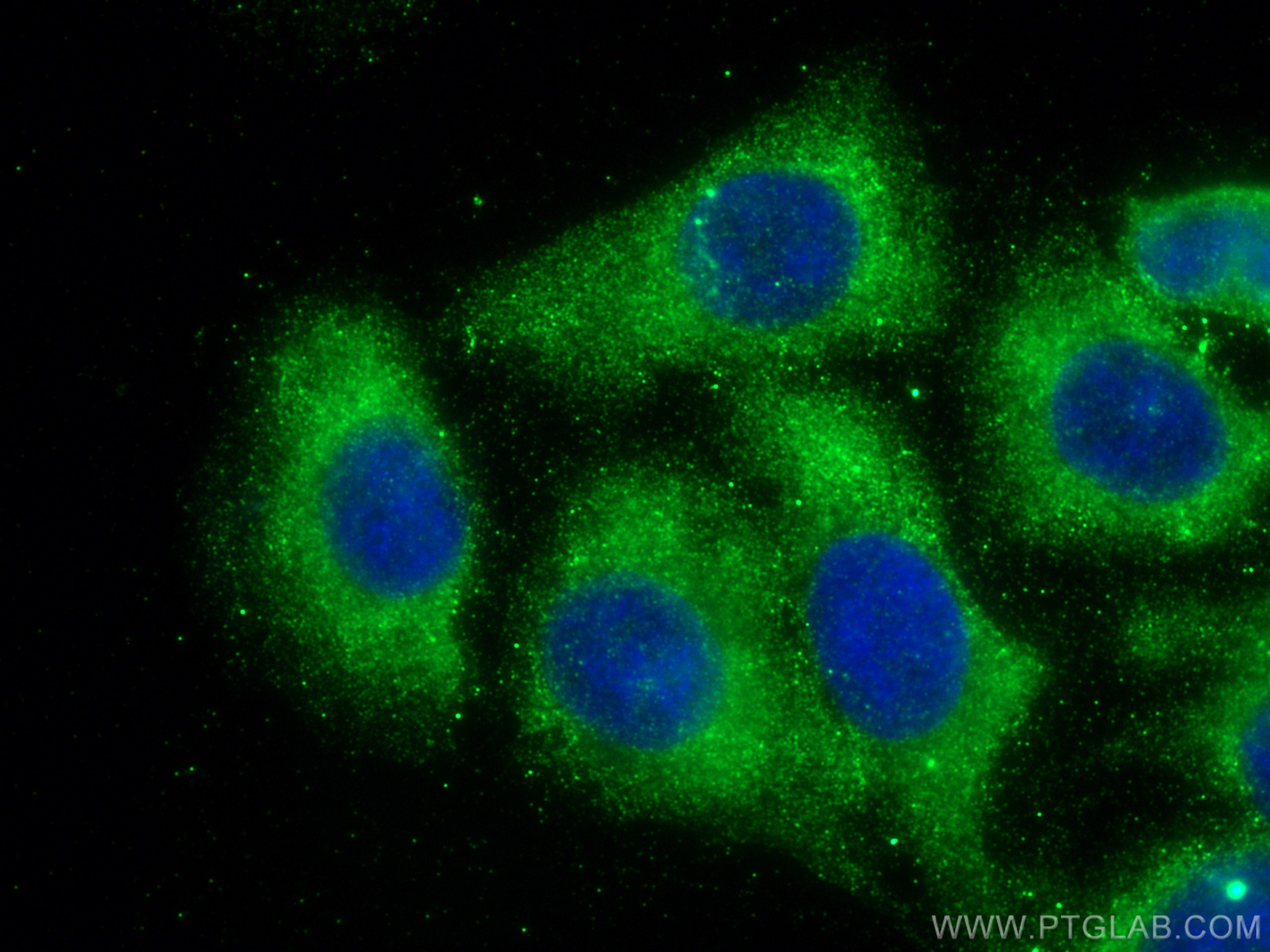 Immunofluorescence (IF) / fluorescent staining of U2OS cells using CCT5 Monoclonal antibody (67400-1-Ig)