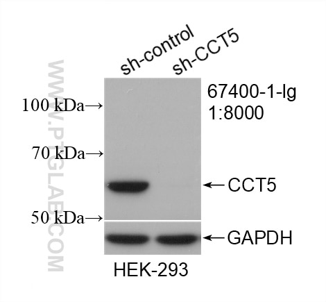 Western Blot (WB) analysis of HEK-293 cells using CCT5 Monoclonal antibody (67400-1-Ig)