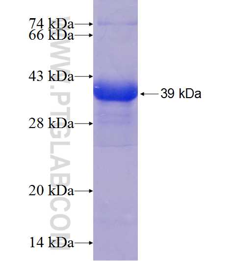 CCT5 fusion protein Ag21421 SDS-PAGE