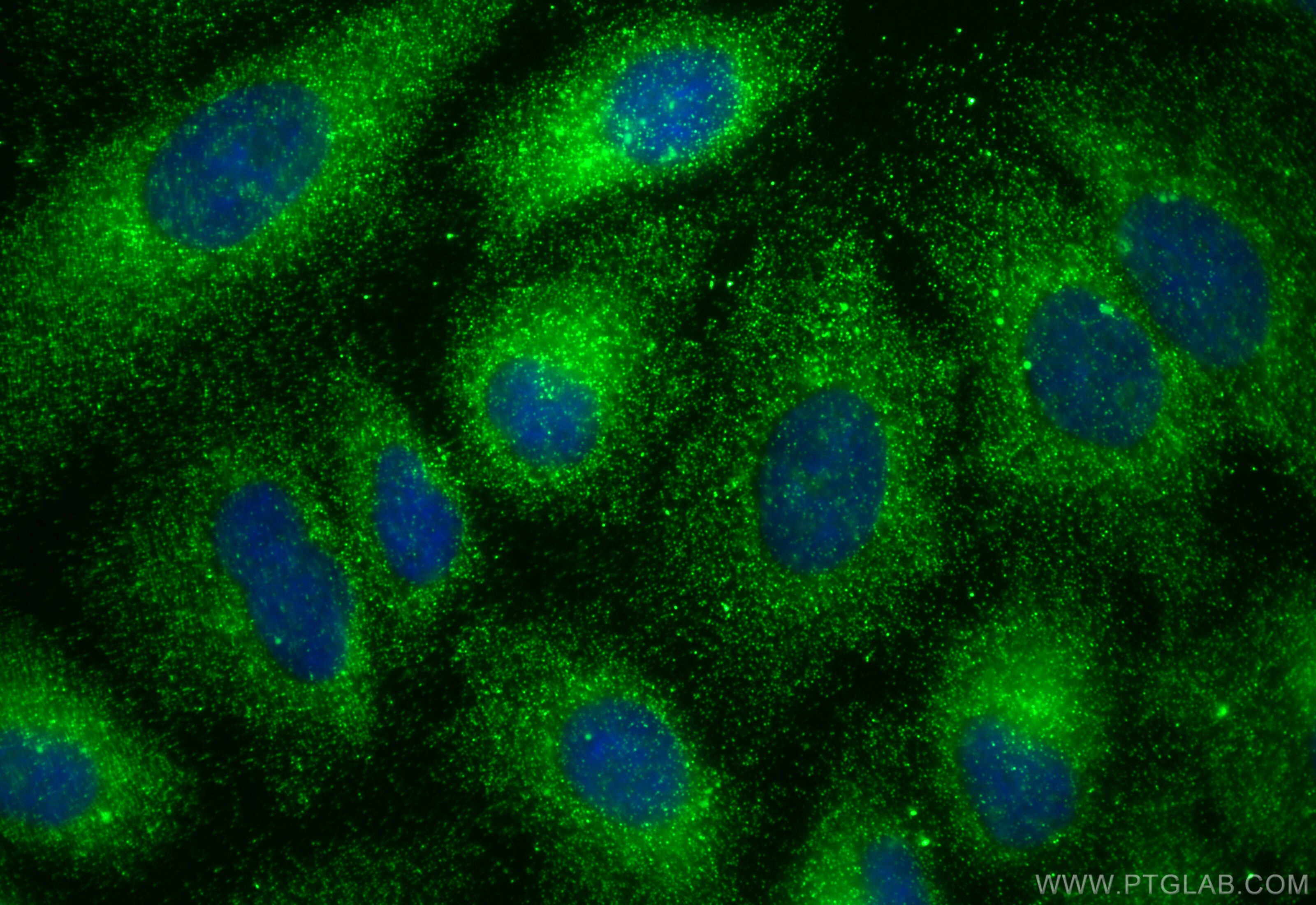 Immunofluorescence (IF) / fluorescent staining of A549 cells using CCT6A-Specific Polyclonal antibody (19793-1-AP)