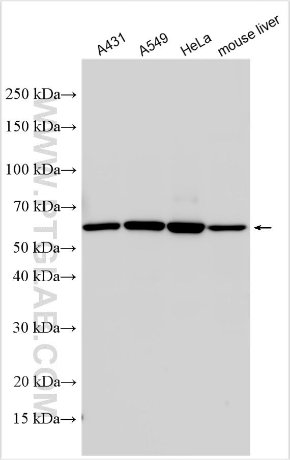Western Blot (WB) analysis of various lysates using CCT6A-Specific Polyclonal antibody (19793-1-AP)