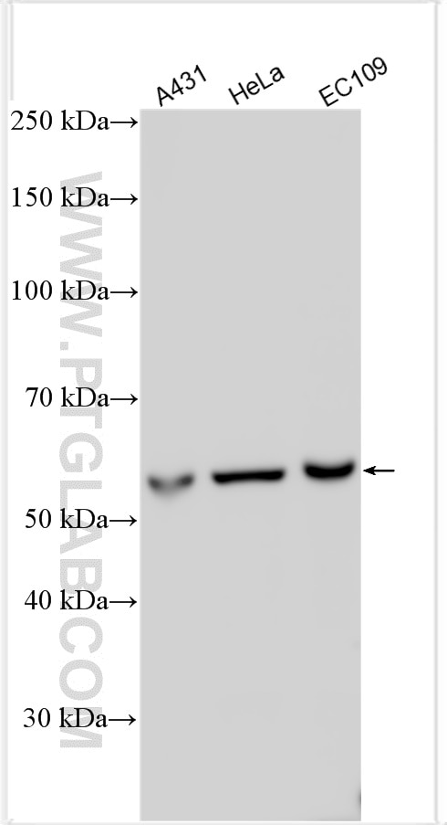 Western Blot (WB) analysis of various lysates using CCT6A-Specific Polyclonal antibody (19793-1-AP)