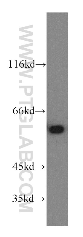 Western Blot (WB) analysis of HeLa cells using CCT6A-Specific Polyclonal antibody (19793-1-AP)