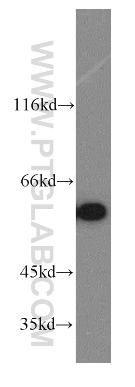 Western Blot (WB) analysis of HeLa cells using CCT6A-Specific Polyclonal antibody (19793-1-AP)