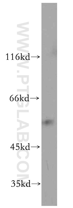 Western Blot (WB) analysis of mouse liver tissue using CCT6A-Specific Polyclonal antibody (19793-1-AP)