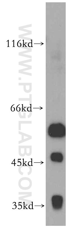 Western Blot (WB) analysis of mouse brain tissue using CCT6A-Specific Polyclonal antibody (19793-1-AP)
