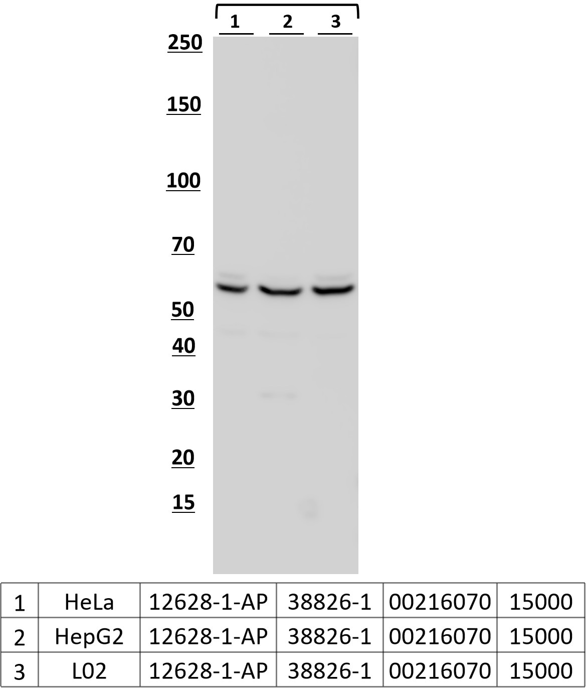 Western Blot (WB) analysis of various lysates using CCT6B Polyclonal antibody (12628-1-AP)
