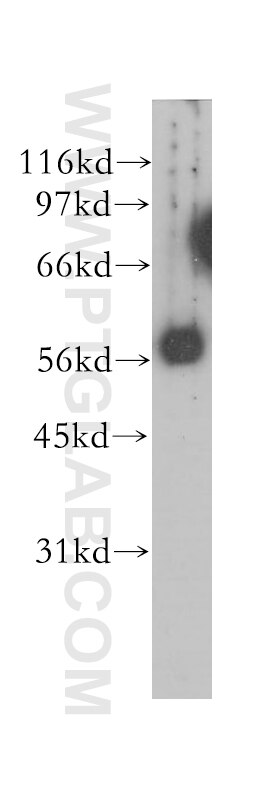 Western Blot (WB) analysis of mouse ovary tissue using CCT6B Polyclonal antibody (12628-1-AP)