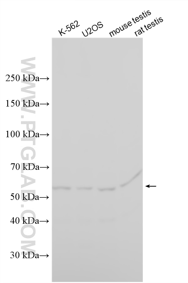 Western Blot (WB) analysis of various lysates using CCT6B Polyclonal antibody (19668-1-AP)