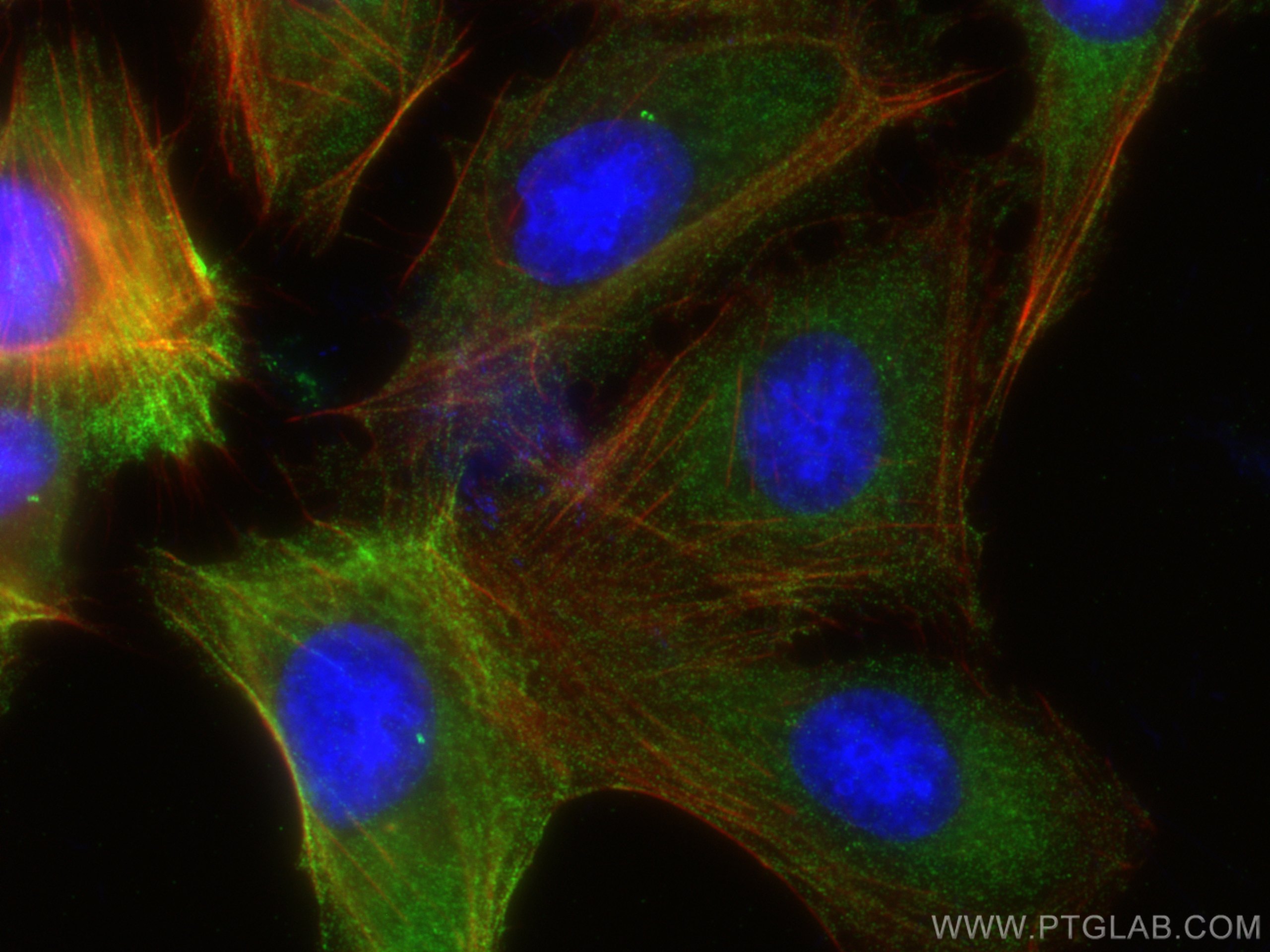 Immunofluorescence (IF) / fluorescent staining of U2OS cells using CCT6B Monoclonal antibody (67961-1-Ig)