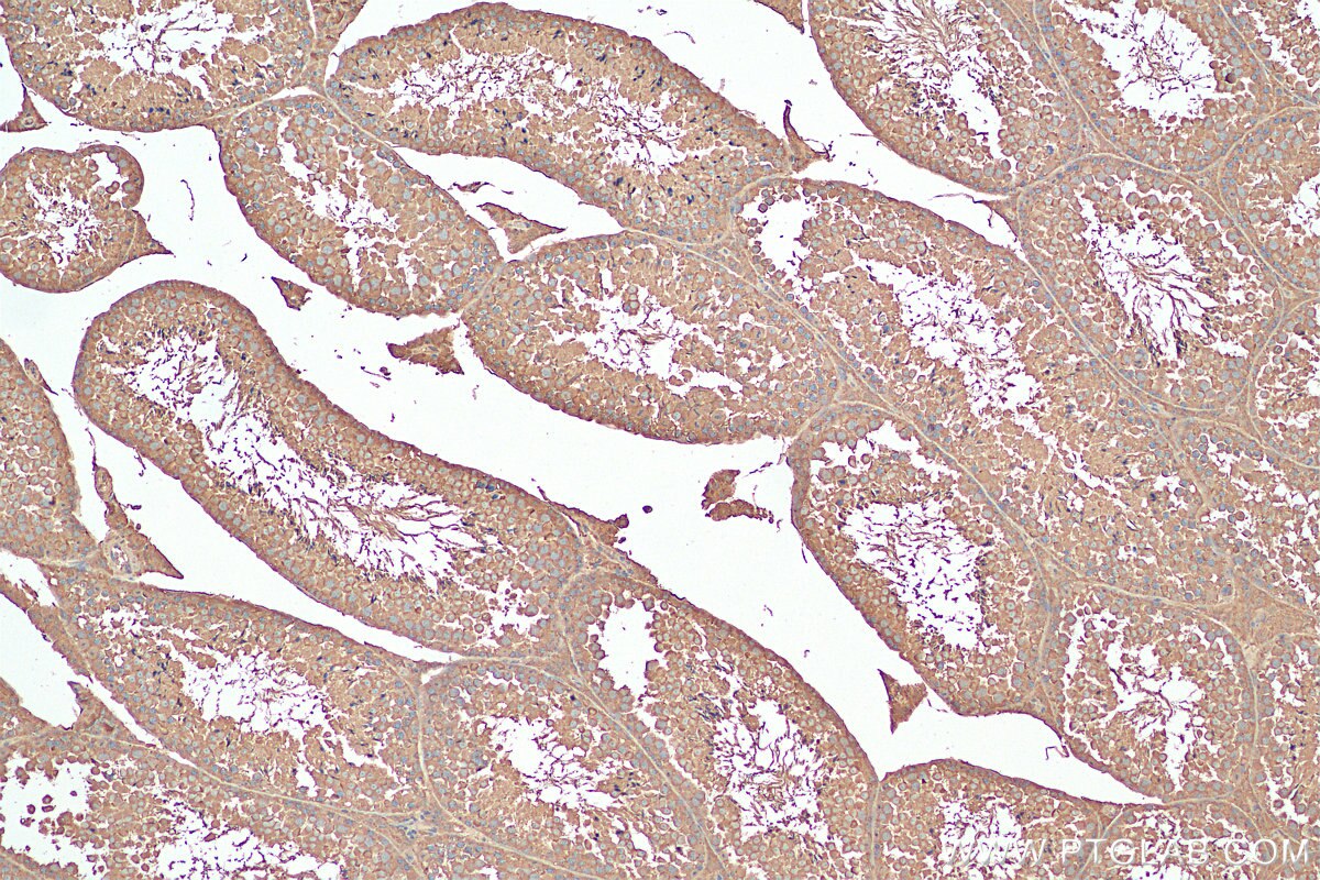 IHC staining of mouse testis using 67961-1-Ig