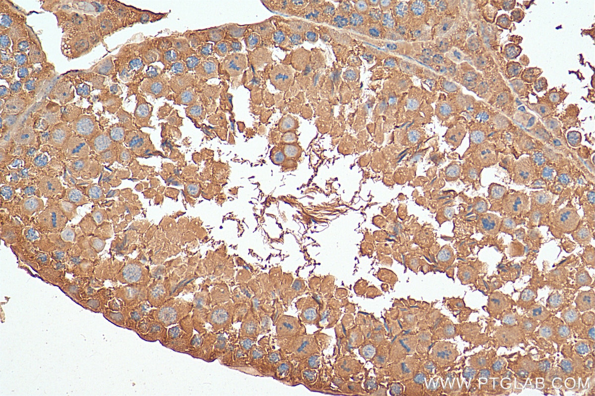 Immunohistochemistry (IHC) staining of mouse testis tissue using CCT6B Monoclonal antibody (67961-1-Ig)