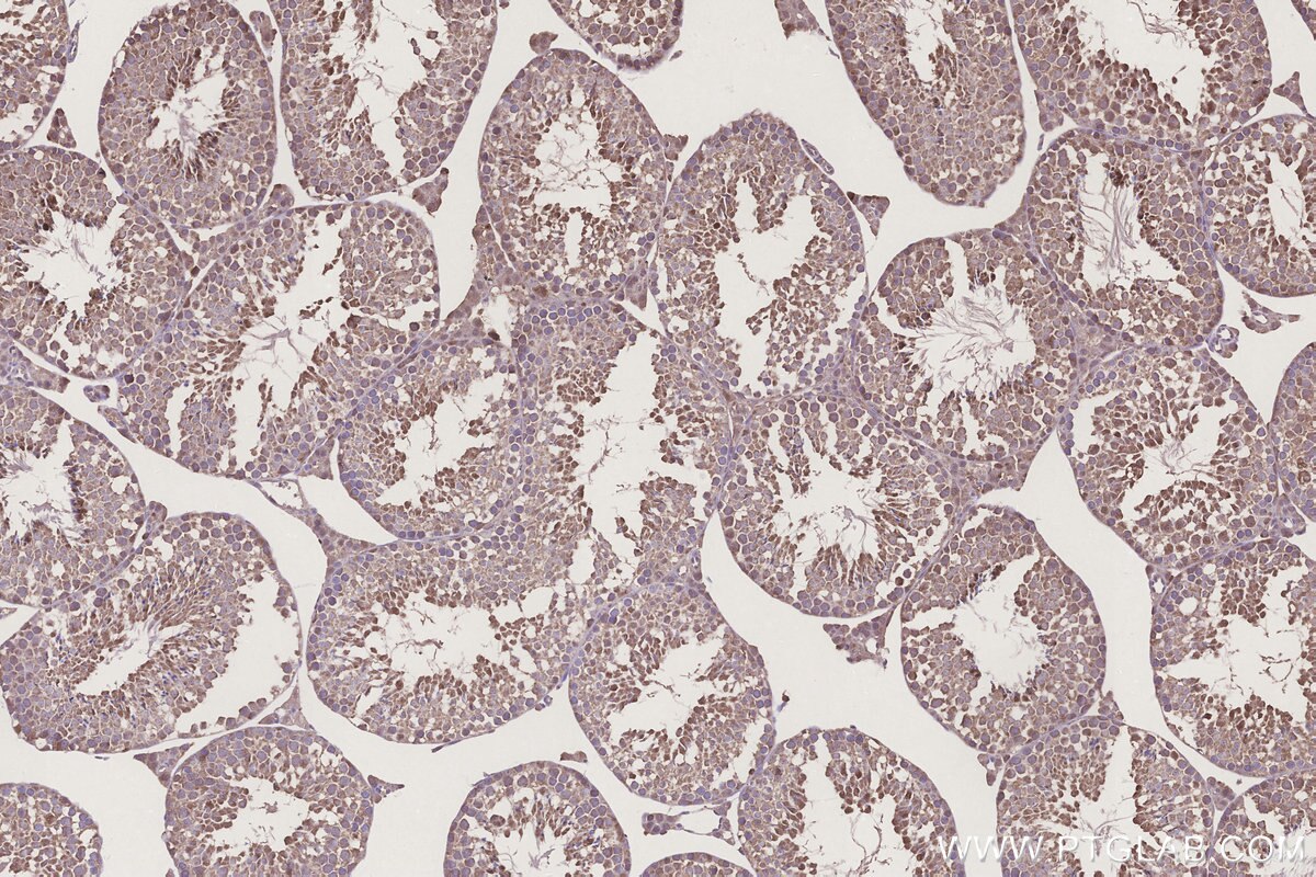 Immunohistochemistry (IHC) staining of mouse testis tissue using CCT6B Monoclonal antibody (67961-1-Ig)